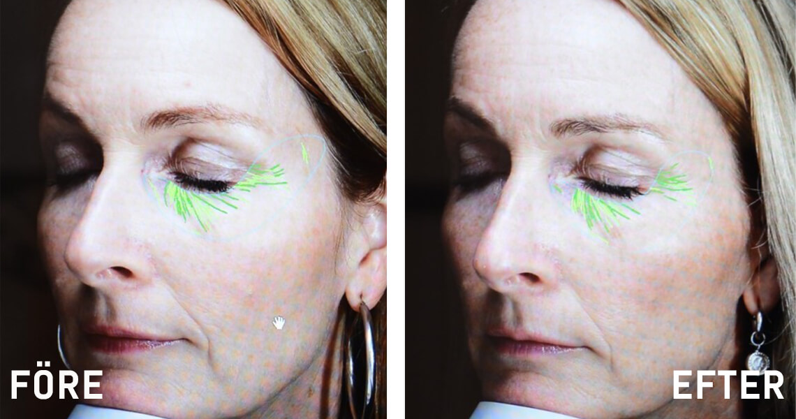 OSL_Before-after_Heidi_w-article_1140x600_SE.jpg