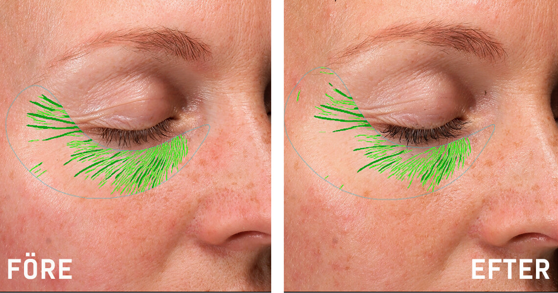 Before-after_web_article_Malin-G2_1140x600_0122.jpg