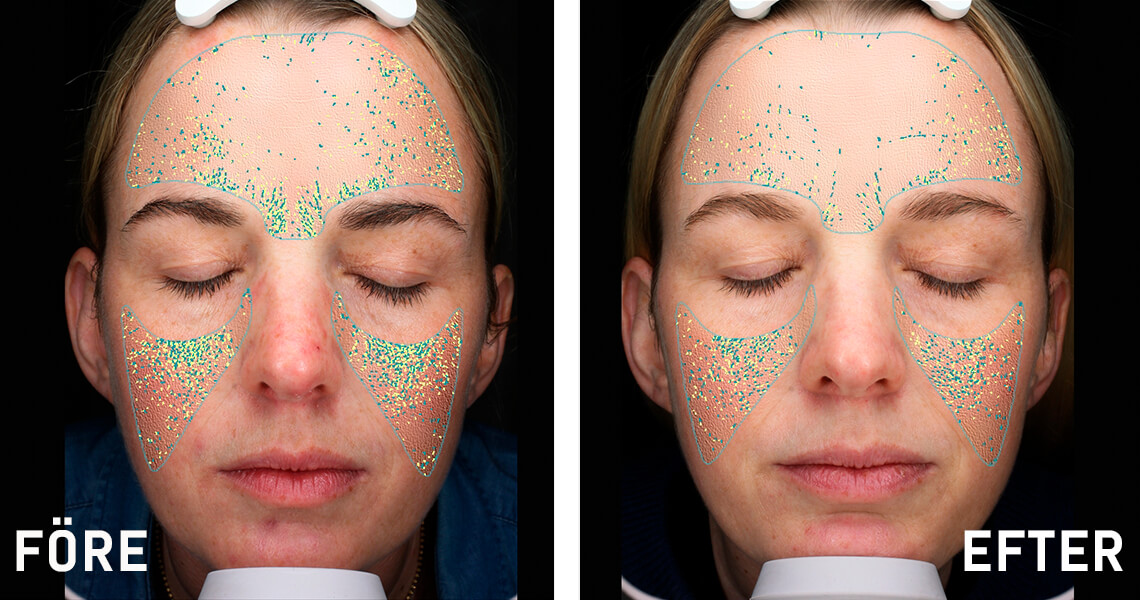 Before-after_web_article_Malin2_1140x600_0122.jpg