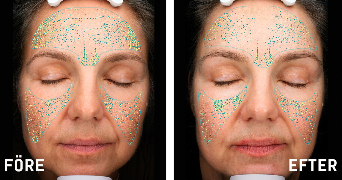 Before-after_web_article_Mia2_1140x600_0122.jpg