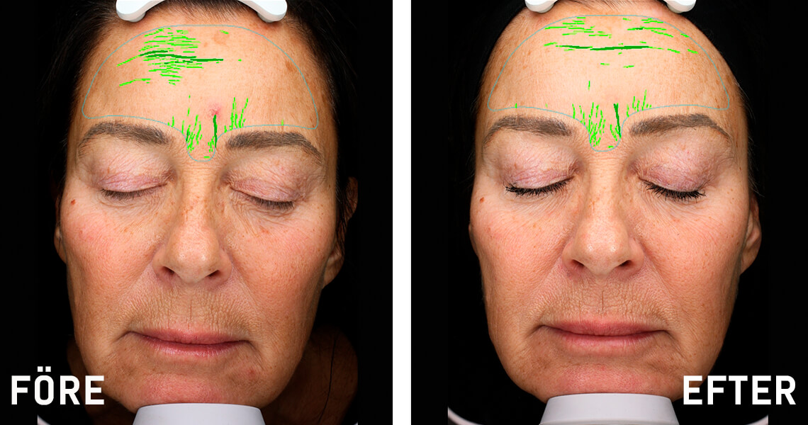 Before-after_web_article_Susan_1140x600_0122.jpg